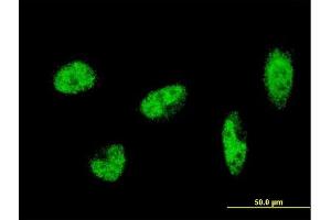 Immunofluorescence of monoclonal antibody to SH2B1 on HeLa cell. (SH2B1 anticorps  (AA 327-426))