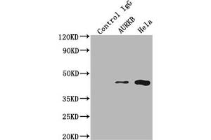 Immunoprecipitating AURKB in Hela whole cell lysate Lane 1: Rabbit control IgG instead of ABIN7127357 in Hela whole cell lysate. (Recombinant Aurora Kinase B anticorps)