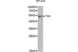 Western blot analysis of extracts of BT-474 cells, using TIA1 antibody. (TIA1 anticorps)
