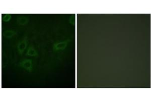 Immunofluorescence analysis of HepG2 cells, using TK (epitope around residue 13) antibody. (TK (N-Term), (Ser13) anticorps)