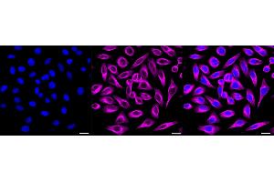 anti-Matrix Metallopeptidase 11 (Stromelysin 3) (MMP11) antibody