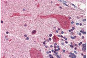 Human Brain, Cerebellum (formalin-fixed, paraffin-embedded) stained with Heat Shock Protein 90 (HSP90) antibody ABIN364328 at 5 ug/ml followed by biotinylated anti-mouse IgG secondary antibody ABIN481714, alkaline phosphatase-streptavidin and chromogen. (HSP90 anticorps  (AA 1-732))