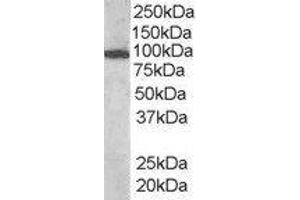 ABIN2560712 (1µg/ml) staining of human bone marrow lysate (35µg protein in RIPA buffer). (VAV3 anticorps  (Internal Region))