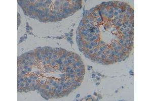 IHC-P analysis of Kidney tissue, with DAB staining. (KEL anticorps  (AA 439-713))