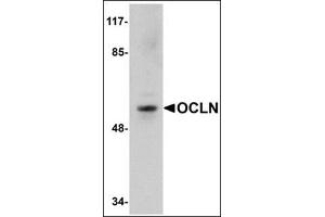 Western blot analysis of OCLN in human liver tissue lysate with this product at 1 μg/ml. (Occludin anticorps  (C-Term))