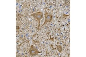IHC analysis of NEFL/NF-L using anti-NEFL/NF-L antibody (ABIN7601626).