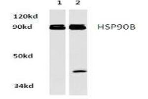 Image no. 2 for anti-Heat Shock Protein 90kDa alpha (Cytosolic), Class B Member 1 (HSP90AB1) antibody (ABIN265474) (HSP90AB1 anticorps)