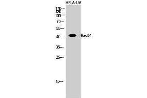 Western Blotting (WB) image for anti-DNA Repair Protein Homolog 1 (RAD51) (Thr555) antibody (ABIN3186658) (RAD51 anticorps  (Thr555))