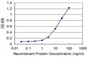 Detection limit for recombinant GST tagged IRAK4 is approximately 1ng/ml as a capture antibody. (IRAK4 anticorps  (AA 255-351))
