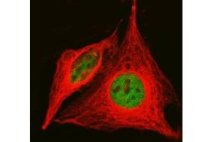 IF analysis of KAT1/HAT1 using anti-KAT1/HAT1 antibody (ABIN7603224) and anti-Tubulin Alpha antibody (ABIN7600339). (HAT1 anticorps  (N-Term))