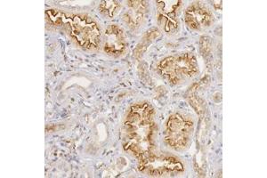 Immunohistochemical staining of human kidney with STX7 polyclonal antibody  shows strong luminal membranous and cytoplasmic positivity in cells in tubules at 1:50-1:200 dilution. (Syntaxin 7 anticorps)