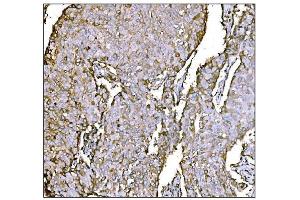 IHC analysis of HCCS using anti-HCCS antibody (ABIN7602424). (HCCS anticorps  (AA 76-268))