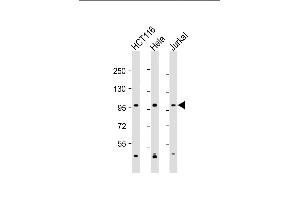 All lanes : Anti-NBA Antibody (C-Term) at 1:2000 dilution Lane 1: HC whole cell lysate Lane 2: Hela whole cell lysate Lane 3: Jurkat whole cell lysate Lysates/proteins at 20 μg per lane. (MANBA anticorps  (AA 712-745))