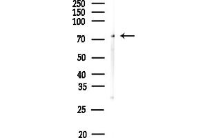anti-DCP1 Decapping Enzyme Homolog A (S. Cerevisiae) (DCP1A) (Internal Region) antibody