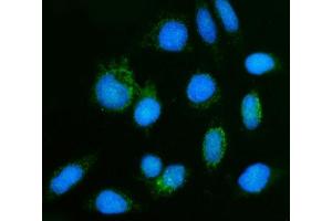 IF analysis of GHITM using anti-GHITM antibody (ABIN7599294). (GHITM anticorps  (AA 1-345))