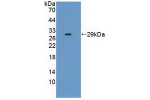 Western blot analysis of recombinant Human IL2Ra. (CD25 anticorps  (AA 22-213))