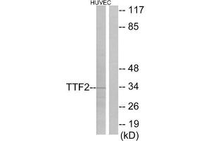 Western Blotting (WB) image for anti-Transcription Termination Factor, RNA Polymerase II (TTF2) (N-Term) antibody (ABIN1848920) (TTF2 anticorps  (N-Term))