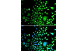 Immunofluorescence analysis of A549 cells using PAX6 antibody. (PAX6 anticorps  (AA 1-300))