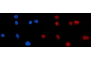 IF analysis of KPNB1 using anti-KPNB1 antibody (ABIN7602502).