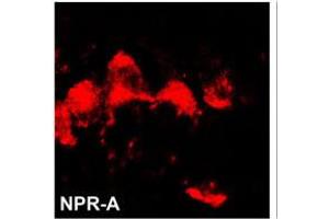 Image no. 1 for anti-Natriuretic Peptide Receptor A/guanylate Cyclase A (Atrionatriuretic Peptide Receptor A) (NPR1) (N-Term) antibody (ABIN360587) (NPR1 anticorps  (N-Term))