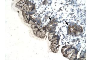 PARP3 antibody was used for immunohistochemistry at a concentration of 4-8 ug/ml to stain Epithelial cells of fundic glands (arrows) in Human Stomach. (PARP3 anticorps)