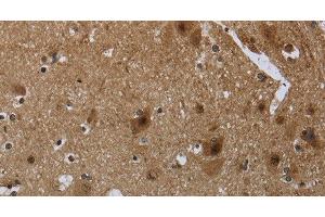 Immunohistochemistry of paraffin-embedded Human brain tissue using CD236 Polyclonal Antibody at dilution 1:60 (CD236/GYPC anticorps)