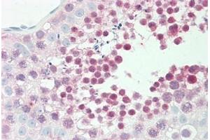 Human Testis: Formalin-Fixed, Paraffin-Embedded (FFPE) (GLRX3 anticorps  (AA 81-110))