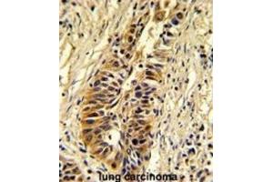 Immunohistochemistry (IHC) image for anti-Transaldolase 1 (TALDO1) antibody (ABIN3002744) (TALDO1 anticorps)