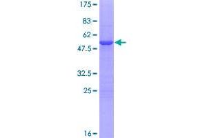Image no. 1 for Paired Related Homeobox 1 (PRRX1) (AA 1-217) protein (GST tag) (ABIN1316455)