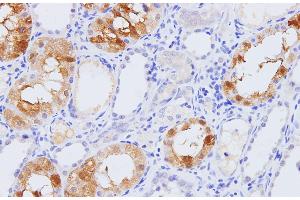Immunohistochemistry of paraffin-embedded Rat kidney using Pck1 Polyclonal Antibody at dilution of 1:100 (PCK1 anticorps)