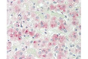 Human Adrenal: Formalin-Fixed, Paraffin-Embedded (FFPE)