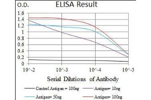 Black line: Control Antigen (100 ng), Purple line: Antigen(10 ng), Blue line: Antigen (50 ng), Red line: Antigen (100 ng), (ALDH2 anticorps  (AA 317-517))