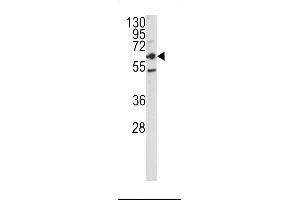 Western blot analysis of CEACAM antibody in HepG2 cell line lysates (35ug/lane)