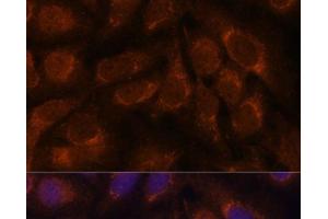 Immunofluorescence analysis of U-2 OS cells using CREB3 Polyclonal Antibody at dilution of 1:100. (CREB3 anticorps)