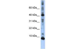 WB Suggested Anti-LSM6 Antibody Titration:  0. (LSM6 anticorps  (N-Term))
