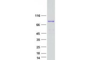 Validation with Western Blot