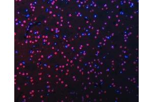 IF analysis of RBM22 using anti-RBM22 antibody (ABIN7600268). (RBM22 anticorps  (AA 17-406))