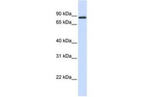 Image no. 1 for anti-Myb-Like Protein 1 (MYBL1) (AA 648-697) antibody (ABIN6743559) (MYBL1 anticorps  (AA 648-697))