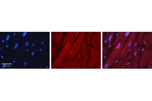 Rabbit Anti-NKX2-5 Antibody Catalog Number: ARP31575_P050 Formalin Fixed Paraffin Embedded Tissue: Human Heart Muscle Tissue Observed Staining: Nucleus Primary Antibody Concentration: 1:100 Other Working Concentrations: 1:600 Secondary Antibody: Donkey anti-Rabbit-Cy3 Secondary Antibody Concentration: 1:200 Magnification: 20X Exposure Time: 0. (NK2 Homeobox 5 anticorps  (N-Term))