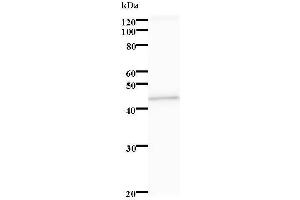 Western Blotting (WB) image for anti-serine/threonine Kinase 38 Like (STK38L) antibody (ABIN931250) (STK38L anticorps)