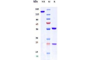 Anti-IL-13Ra1 / CD213a1 Reference Antibody (MK-6105) on SDS-PAGE under reducing (R) condition.