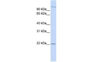 PDS5B antibody used at 1 ug/ml to detect target protein. (PDS5B anticorps)