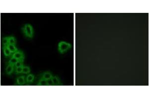 Immunofluorescence analysis of MCF7 cells, using PE2R4 Antibody. (PTGER4 anticorps  (AA 321-370))