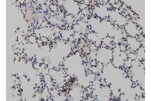 ABIN6272933 at 1/100 staining Mouse lung tissue by IHC-P. (TET2 anticorps  (Internal Region))
