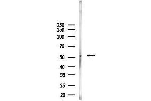 anti-4-Aminobutyrate Aminotransferase (ABAT) (Internal Region) antibody