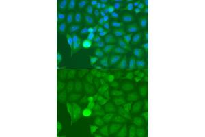 Immunofluorescence analysis of A549 cells using IRAK2 antibody. (IRAK2 anticorps)