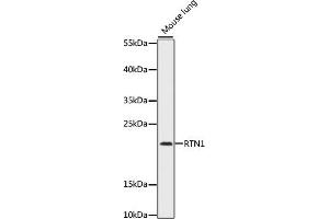 Western blot analysis of extracts of mouse lung, using RTN1 antibody (ABIN7269928) at 1:1000 dilution. (Reticulon 1 anticorps  (AA 80-340))