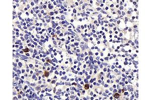 Immunohistochemistry analysis of paraffin-embedded rat lymph node using BAG2 Polyclonal Antibody at dilution of 1:400. (BAG2 anticorps)