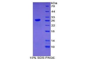 SDS-PAGE analysis of Mouse CLEC10A Protein.