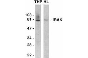Western blot analysis of IRAK in THP-1 (THP) and HeLa (HL) whole cell lysates with AP30438PU-N IRAK antibody at 1/2000 dilution. (IRAK1 anticorps  (C-Term))